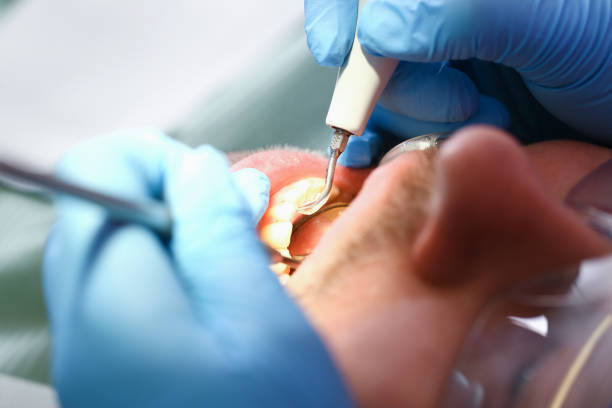 Best Dental Abscess Treatment in Fordoche, LA