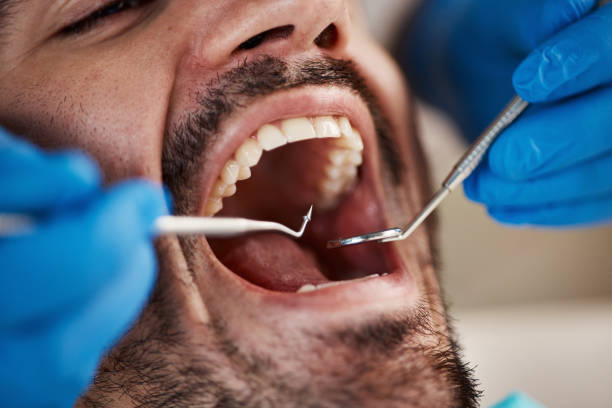 Best Emergency Orthodontic Repairs in Fordoche, LA