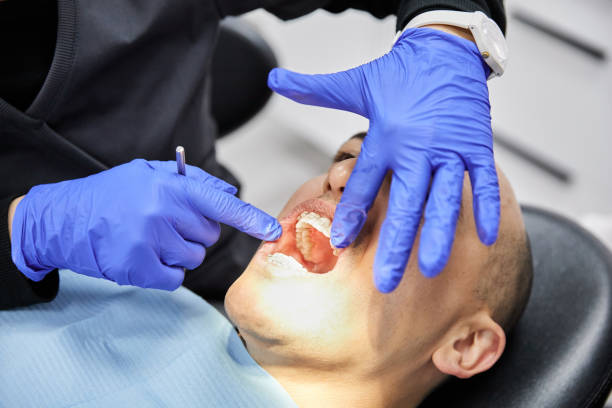 Best Emergency Wisdom Tooth Extraction in Fordoche, LA